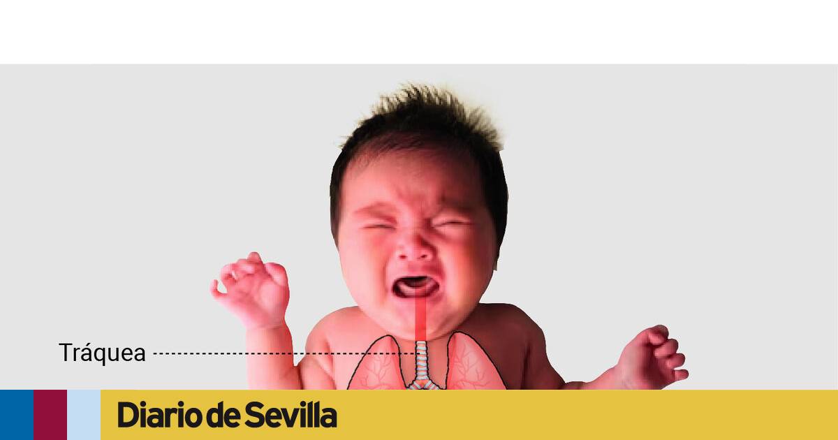Vacuna contra la bronquiolitis: Andalucía inicia la inmunización en pediatría